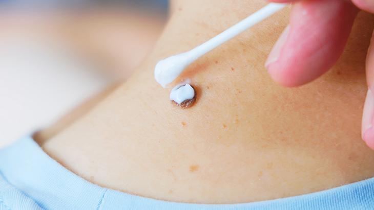 lazerle aldiran da var solusyon suren de her ben masum degil incelenmeli 3X8XTm9w.jpg